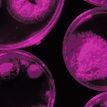 Piece of Access Microbiology cover, with abstract purple shapes in a dark background
