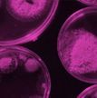 Piece of Access Microbiology cover, with abstract purple shapes in a dark background