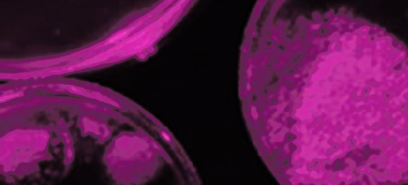 Piece of Access Microbiology cover, with abstract purple shapes in a dark background