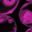 Piece of Access Microbiology cover, with abstract purple shapes in a dark background