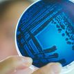 Petri dish with colonies