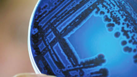 Petri dish with colonies