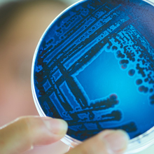 Petri dish with colonies