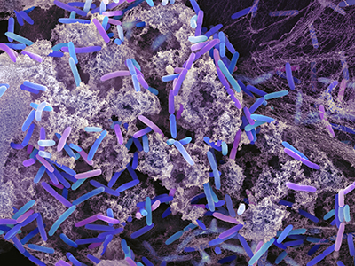 Computer illustration of Coloured SEM of Pseudomonas aeruginosa bacteria. 