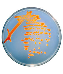 Haloferax volcanii grown in the lab on agar