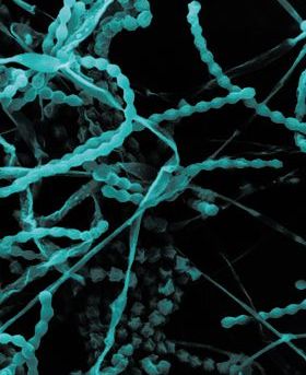 Scanning electron microscope image of fungi