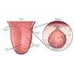 Diagram of salivary glands in the tongue