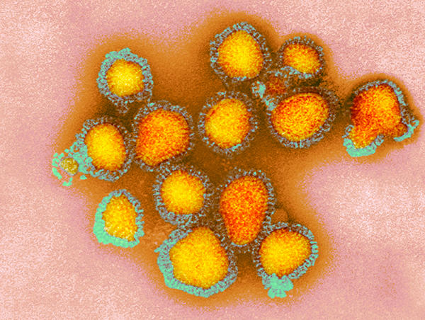 H3N2 influenza virus particles