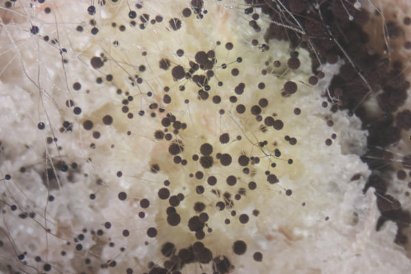 Rhizopus bread mold under microscope