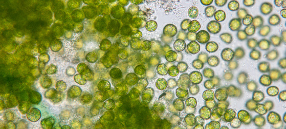 Microbiology media guide image (2).jpg