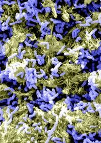 Microscopic image of Pseudomonas aeruginosa biofilms.