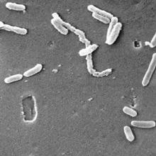 Pseudomonas aeruginosa under a SEM CDC Janice Haney Carr.jpg