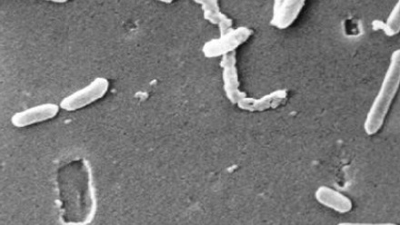Pseudomonas aeruginosa under a SEM