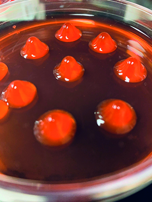 Pseudomonas aeruginosa colonies sourced from a cystic fibrosis sputum sample. 