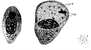 MT May 2013 Chlamydia 1