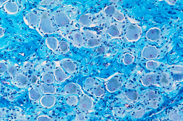 MT Feb 2014 nerve ganglion