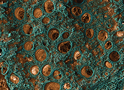 Colour-enhanced SEM of a rotten oak branch.