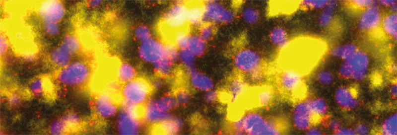 Confocal laser scanning microscopy image taken of a co-culture of Pseudomonas aeruginosa PAO1 (yellow cells) and P. aeruginosa PAO4 (blue cells).