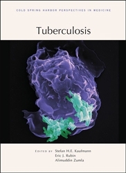 MT Aug 16 reviews tuberculosis