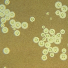 MT Nov 2012 7 Article Gow Cryptococcus neoformans