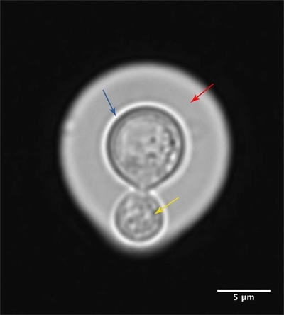 MT Feb 16 cryptococci fig1