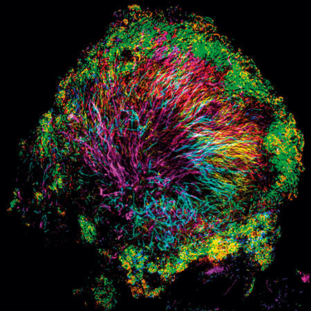 MT-Feb-18-fluorescence-hedgehog.jpg