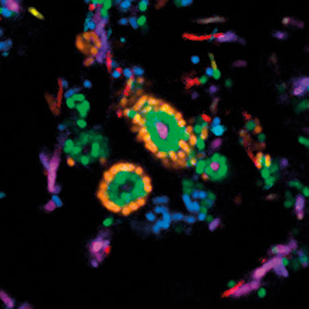 MT-Feb-18-fluorescence-corncob.jpg