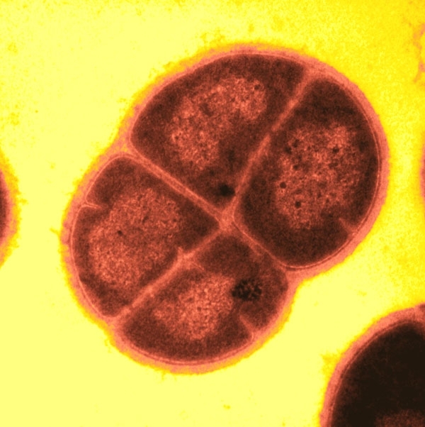 Extremophile organisms: Deinococcus radiodurans. Science blog 121