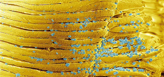 MT-May-17-microbiome-of-things-deep-sea-bacteria.jpg