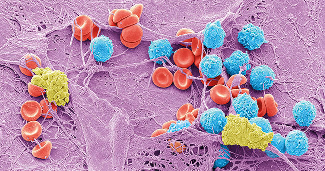 Staphylococcus Epidermidis Bacteria by Steve Gschmeissner