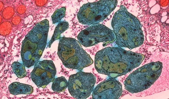 MT Feb 15 toxoplasma t gondii