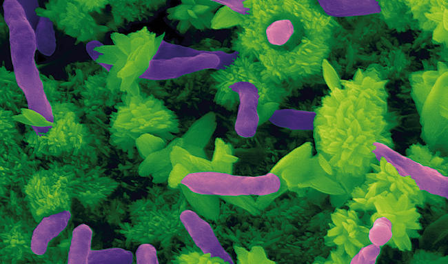 MT-May-17-beyond-the-gut-rhodobacter.jpg