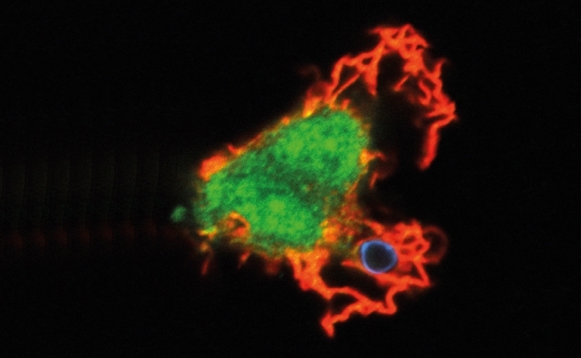 MT Feb 16 cryptococci fig2