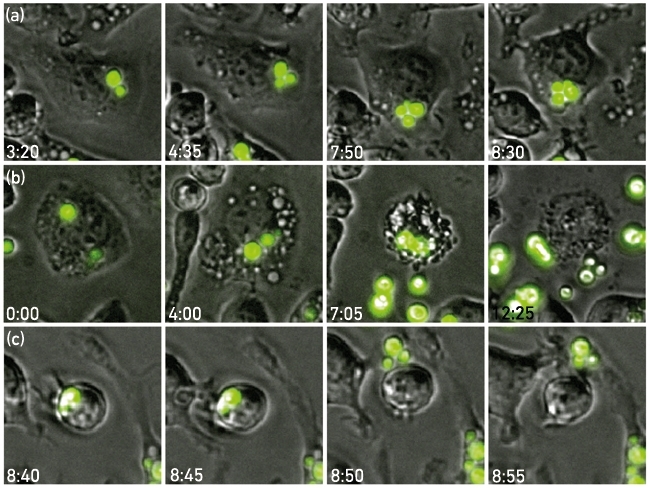 MT Feb 16 cryptococci fig3