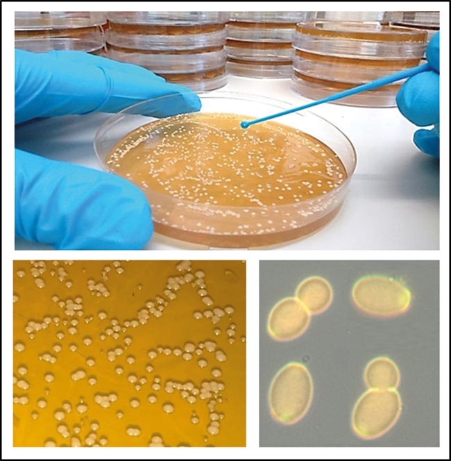 MT Feb 16 candida fig1