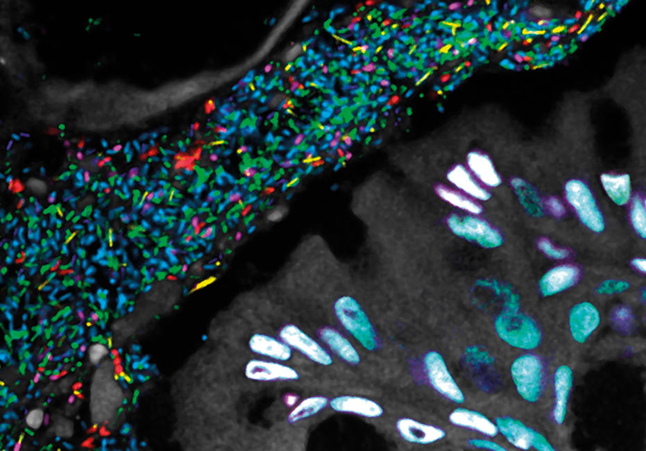 MT-Feb-18-fluorescence-mouse-colon.jpg