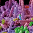 MT-May-17-status-perspectives-oral-bacteria.jpg
