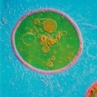 MT Feb 2016 cryptococci micrograph