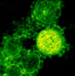 Towards-a-universal-coronavirus-vaccine-science-fact-or-science-fiction-110x110px-thumbnail.jpg