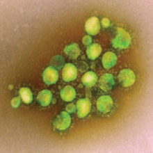 MT Aug 2013 MERS Coronavirus