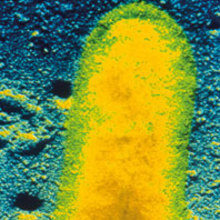 MT May 2014 TEM R.bacterium