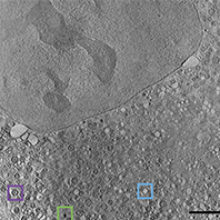 MT-Feb-18-x-rays-cryosxt.jpg