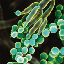 MT Feb 2016 mycotoxins penicillum