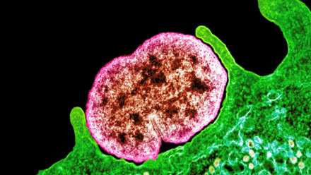 MT May 2013 gonorrhoea