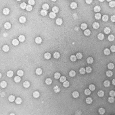 Transmission electron micrograph of human rhinovirus, the main causative agent of the common cold. 