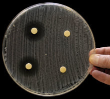 MT Nov 2012 9 Article Bode Fig 9 zone of inhibition Dani