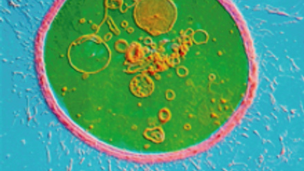 MT Feb 2016 cryptococci micrograph