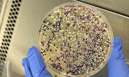 Agar plate with bacteria grown from a yoga mat swab