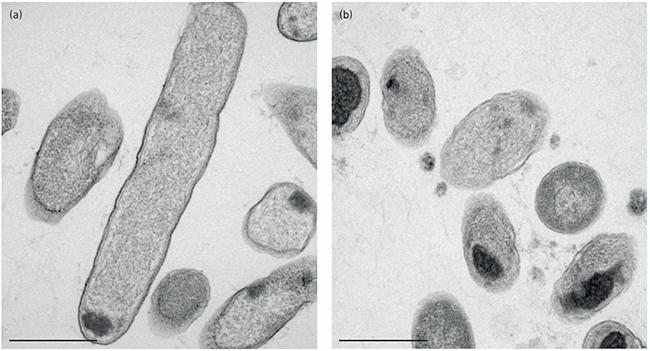 2 electron microscopy micrographs of Pseudomonas aeruginosa, (a) untreated and (b) treated with GA. Aggregates show as dark spots within the cells, with more and darker spots in (b) than (a).
