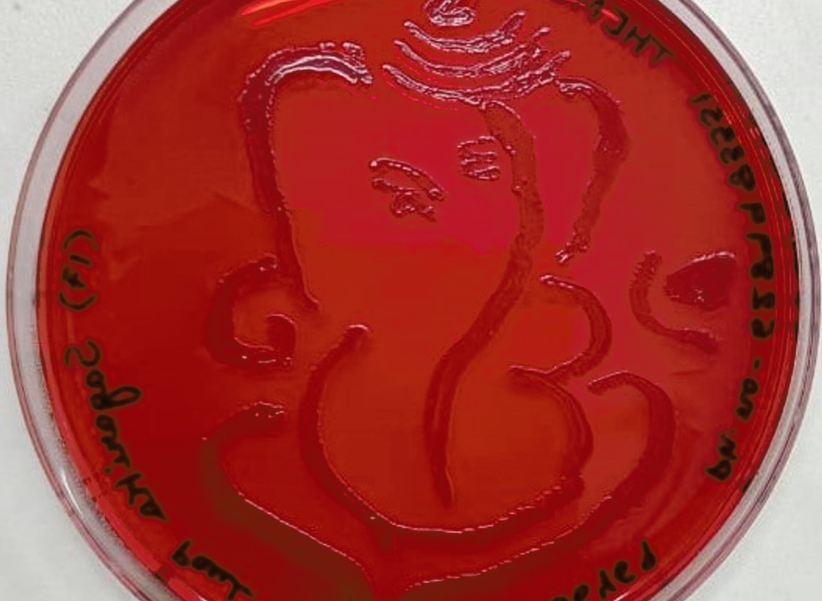 Agar art plate 1